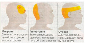 Причины головной боли в затылке Медикаментозное лечение головной боли
