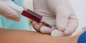 Кровь из вены Процедуры аутогемотерапии проводятся по определенной врачом схеме