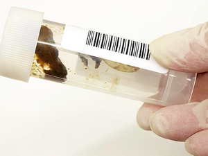 Как правильно собирается кал для анализа Сбор кала для анализа