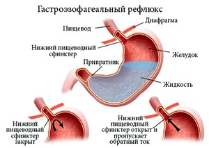 Диета при заболевании Как питаться при заболевании