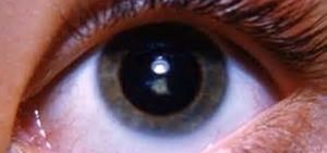 Особенности питания при катаракте Как лечат катаракту народными средствами