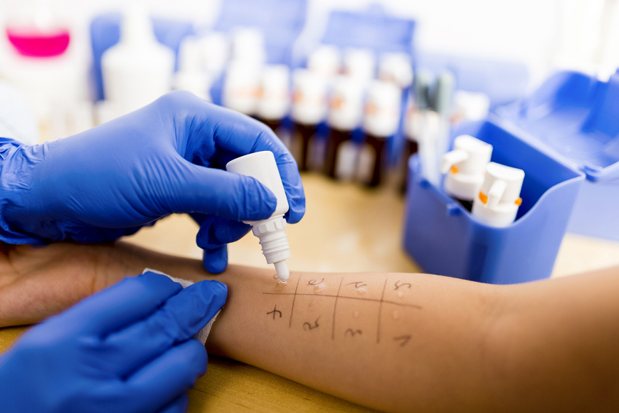 Как подготовиться и провести тест на аллергию?