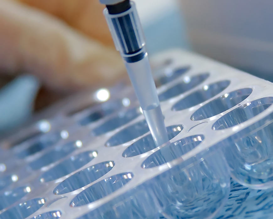 Как подготовиться и провести тест на аллергию?