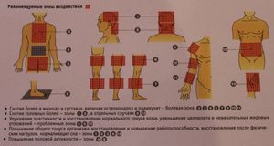 Отзывы об аппликаторе Кузнецова Аппликатор Кузнецова