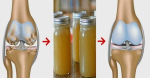 Как приготовить желатин на воде Применение желатина при больных суставах