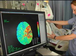 Компьютерная томография Диагностика церебрального атеросклероза