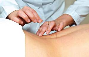 История происхождения методики Как произошла методика лечения