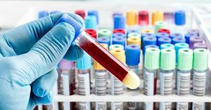 Подготовка сдачи крови на гормоны щитовидной железы Как сдавать кровь на гормоны щитовидной железы