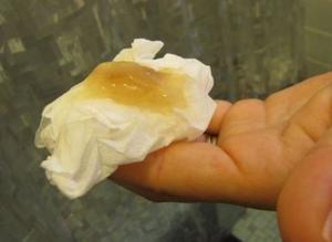 Внешний вид слизистой пробки перед родами Обязательно ли должна отойти пробка