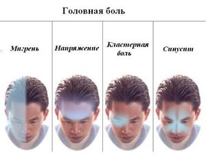 Лечение головной боли Лечение головных болей