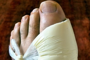 Что делать при обострении подагры в домашних условиях Средства и способы лечения при обострении подагры в домашних условиях