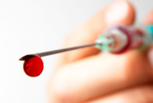 Аутогемотерапия Одним из способов лечения прыщей является переливание свой крови или аутогемотерапия