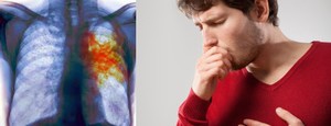 Заболевание лёгких Как проявляетсяя рак лёгких