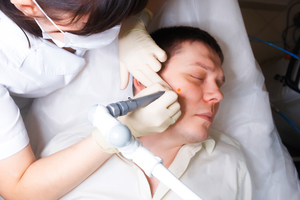 Удаление папилломы в домашних условиях Как в домашних условиях удалить папиллому