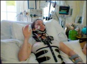 Симптомы компрессионного перелома позвоночника поясничного отдела Лечение перелома позвоночника поясничного отдела