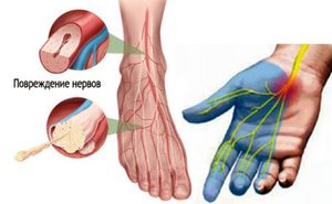 Характер и специфика поражения Проявление заболевания
