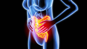 Нарушение перистальтики Нарушение перистальтики кишечника