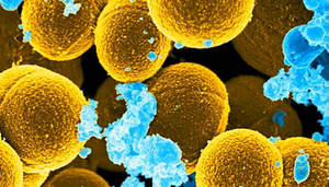 Лечение стафилококка Симптомы заболевания