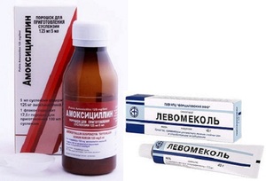 Чем лечить стрептодермию у взрослых Препараты и способы лечения стрептодермии у взрослых