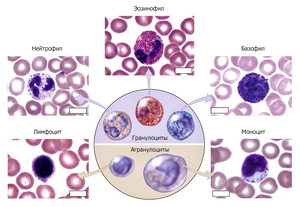 Как понизить лейкоциты в мазке Как лечить повышенный уровень лейкоцитов