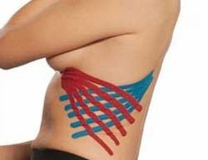 Диагностика заболевания Как проявляется межреберная невралгия