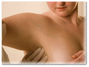 Новообразование Новообразование молочной железы