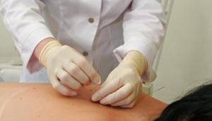 Как проводится рефлексотерапия Кем может проводится процедура