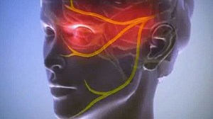 Как лечить воспаление тройничного нерва Лечение невралгии