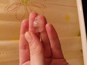 Выход пробки перед родами Как отходит пробка перед родами