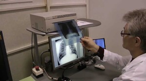 Плюсы цифровой флюорографии Какие бывают плюсы флюорографии