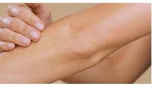 Возможные болезни локтей С чем связан зуд локтей