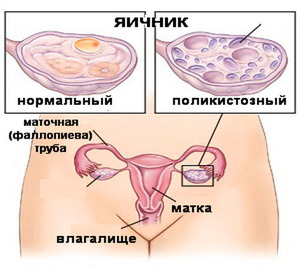 Возможные последствия Какие могут быть последствия