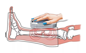 Магнитотерапия Аппарат АМнп-01 имеет 4 режима и удобен в использовании