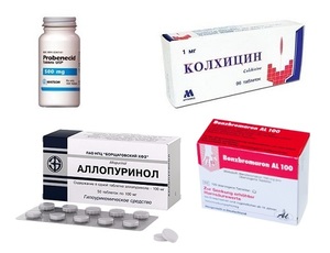 Какие лекарственные препараты применяются для лечения подагры Перечень и описание лекарственных средств для лечения подагры