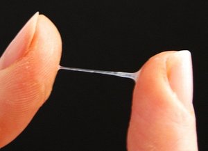 Понятие нормы выделений Влагалищные выделения