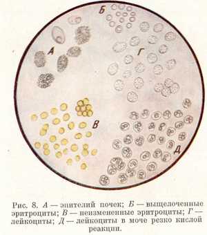 Диагностика заболевания Как сдать мазок на анализ