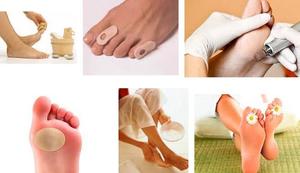 Что делать, чтобы от прыщей не осталось следов Гнойные прыщи на ногах у женщин