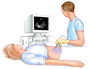 Как избежать внематочной беременности — профилактические меры и советы от гинекологов Как избежать внематочной беременности