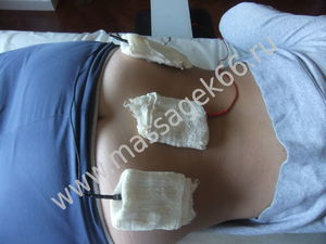 Проведение процедуры Проведение процедуры электрофореза