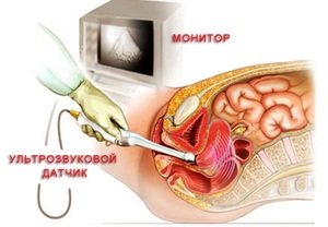 Подготовка к процедуре узи Как подготовиться к узи
