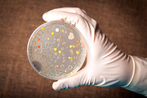 Анализ кала на ротавирус Диагностика ротавирусной инфекции