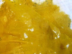 Стул грудничка при лактазной недостаточности Расстройство стула при лактазной недостаточности