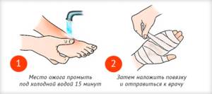 Первая помощь при химическом ожоге Что нужно делать при химическом ожоге