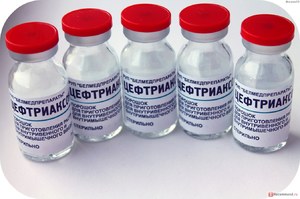 Какие побочные эффекты может вызвать Цефтриаксон Побочные эффекты, которые может вызвать Цефтриаксон