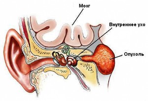 Лечение вестибулярного аппарата Какую диагностику проходить