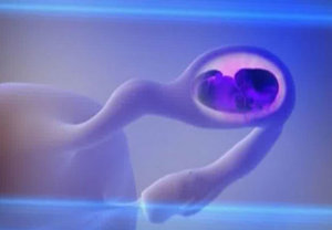 Как отличить внематочную беременность от нормальной Покажет ли тест внематочную беременность до задержки