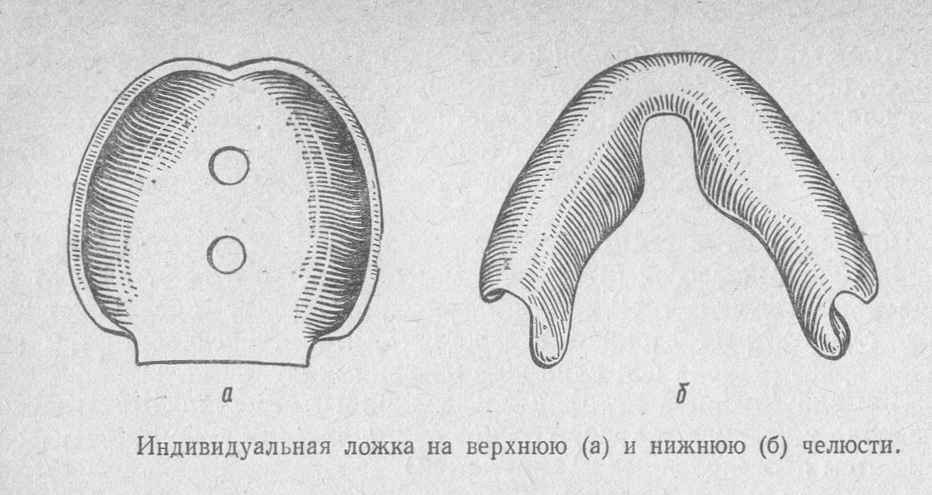 Индивидуальные оттиски