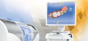 Технология CEREC