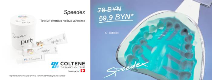 Speedex масса для слепков