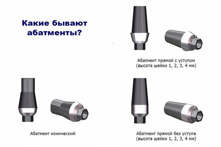 абатменты